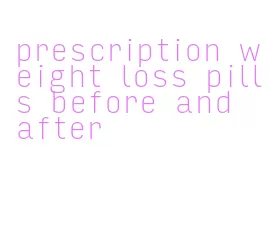 prescription weight loss pills before and after