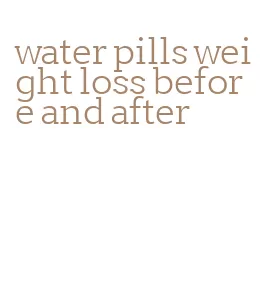 water pills weight loss before and after