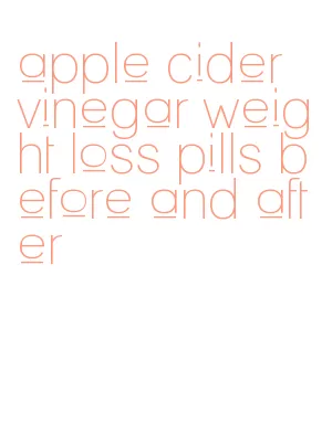 apple cider vinegar weight loss pills before and after