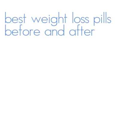 best weight loss pills before and after