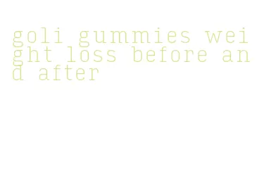 goli gummies weight loss before and after