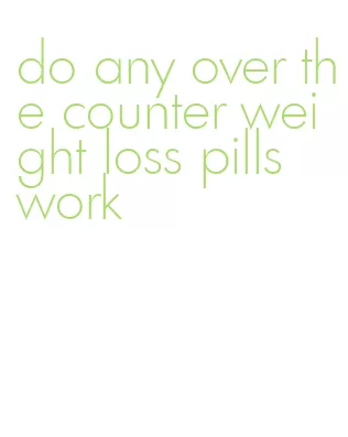 do any over the counter weight loss pills work
