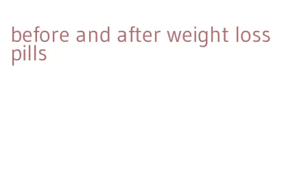 before and after weight loss pills
