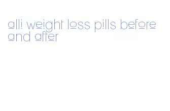 alli weight loss pills before and after