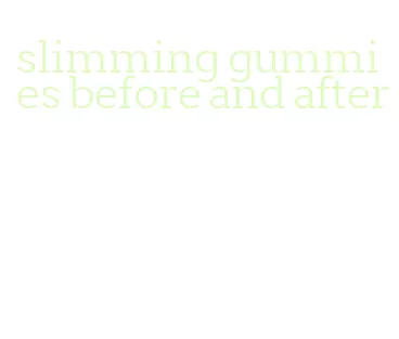 slimming gummies before and after