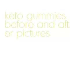 keto gummies before and after pictures