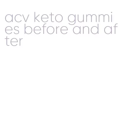 acv keto gummies before and after