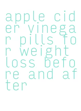 apple cider vinegar pills for weight loss before and after