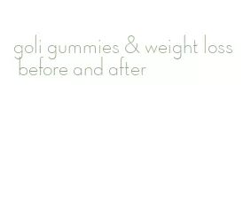 goli gummies & weight loss before and after