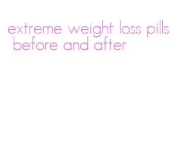 extreme weight loss pills before and after