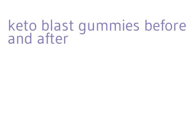 keto blast gummies before and after