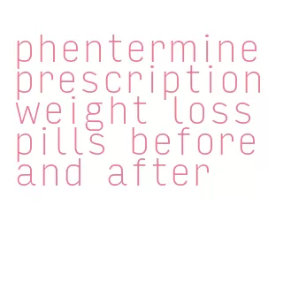 phentermine prescription weight loss pills before and after