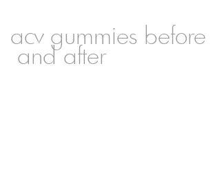 acv gummies before and after