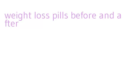 weight loss pills before and after