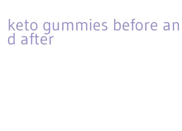 keto gummies before and after