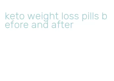 keto weight loss pills before and after