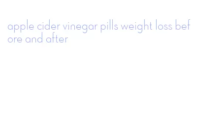 apple cider vinegar pills weight loss before and after